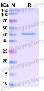 Recombinant Human KIF7 Protein, N-His