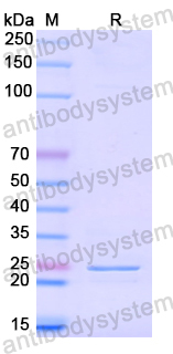 Recombinant Human ATG2A Protein, N-His-SUMO & C-Strep