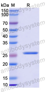 Recombinant Human TIMM50 Protein, N-His