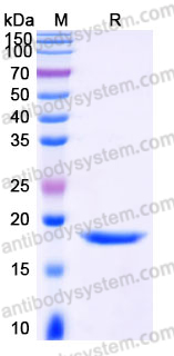 Recombinant Human LGALSL Protein, C-His