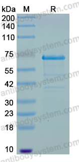 Recombinant Human PARP14 Protein, C-His