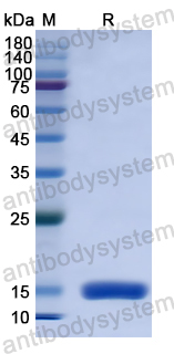 Recombinant Human TIGIT Protein, N-His