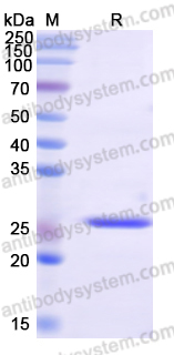 Recombinant Human LARP7 Protein, N-His