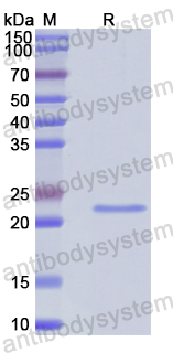 Recombinant Human SLC22A6 Protein, N-His-SUMO