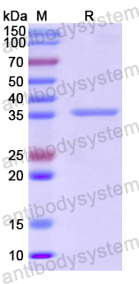Recombinant Human PDCD4/PD4 Protein, N-His