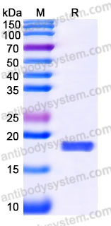Recombinant Human PDCD4 Protein, C-His