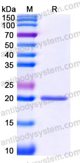 Recombinant Human PHLDA2 Protein, C-His