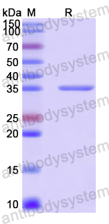 Recombinant Human KLHL22 Protein, N-His