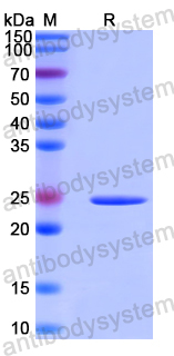 Recombinant Human ARHGAP15 Protein, N-His