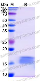 Recombinant Human CCDC93 Protein, N-His