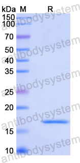 Recombinant Human TMEM97 Protein, N-His-SUMO
