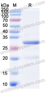 Recombinant Human UBAP2 Protein, N-GST & C-His