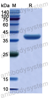 Recombinant Human MUC17 Protein, N-His