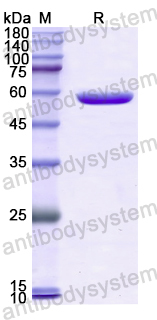 Recombinant Human MAST2 Protein, N-GST
