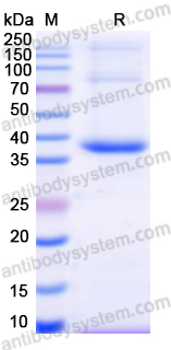 Recombinant Human SLC27A1 Protein, N-His
