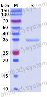 Recombinant Human ATAD2 Protein, N-His