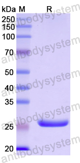 Recombinant Human IL27RA Protein, N-His