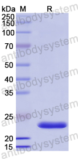 Recombinant Human SOSTDC1 Protein, N-His