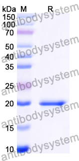Recombinant Human CCDC80 Protein, N-His