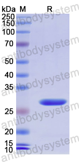 Recombinant Human NOTCH2NLA Protein, N-His