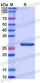 Recombinant Human METTL3 Protein, N-His