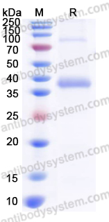 Recombinant Human PIM3 Protein, N-His