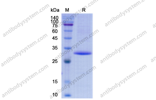 Recombinant Human STING1/TMEM173 Protein, N-His