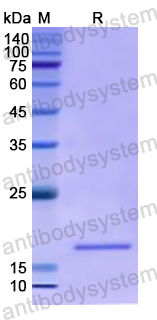 Recombinant Human DGKH Protein, N-His