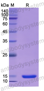 Recombinant Human PDPN Protein, N-His