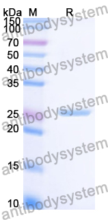 Recombinant Human PDPN/Podoplanin Protein, N-His-KSI