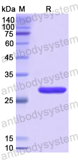 Recombinant Human TICAM1 Protein, N-His
