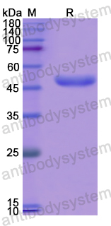 Recombinant Human WDFY1 Protein, N-His