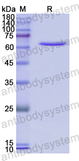 Recombinant Human SULF2 Protein, N-GST