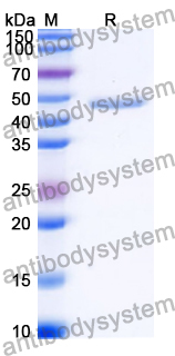 Recombinant Human SULF2 Protein, N-His