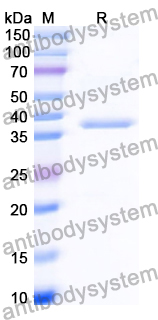 Recombinant Human SULF2 Protein, N-His