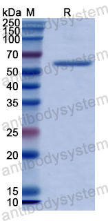 Recombinant Human SULF1 Protein, N-GST