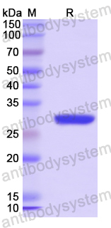 Recombinant Human CNTN4 Protein, N-His