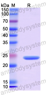 Recombinant Human SCUBE3 Protein, N-His