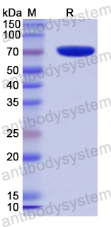 Recombinant Human SIRT2 Protein, N-GST