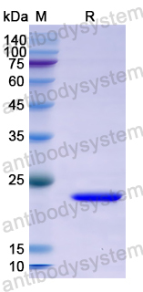 Recombinant Human ABI1 Protein, N-His