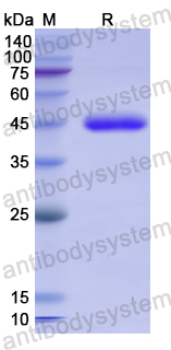 Recombinant Human MYOCD Protein, N-His