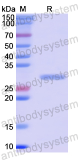 Recombinant Human MYOCD Protein, N-His-SUMO & C-Strep