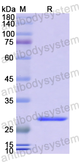 Recombinant Human MPP5 Protein, N-His