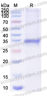Recombinant Human SFRP1 Protein, N-His