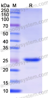 Recombinant Human FTMT Protein, N-His