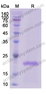Recombinant Human FNDC5 Protein, N-His