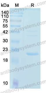 Recombinant Human MCU Protein, N-His