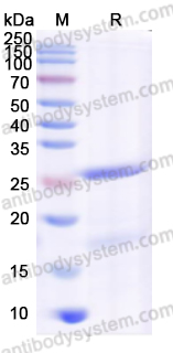 Recombinant Human IL27A/IL30 Protein, N-His