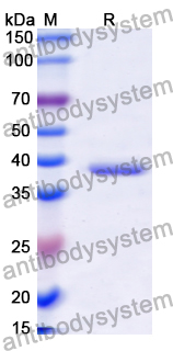 Recombinant Human CD99L2 Protein, N-GST & C-His
