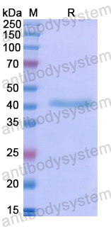 Recombinant Human GPT2 Protein, N-His